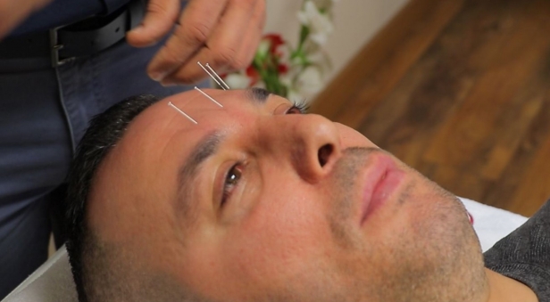 MD Clinic Acupuncture with Migraine Treatment