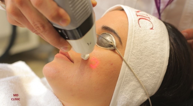 MD Clinic Fractional Laser